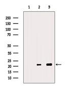 RAC2 Antibody in Western Blot (WB)