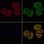 RRM1 Antibody in Immunocytochemistry (ICC/IF)