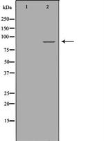 RRM1 Antibody in Western Blot (WB)