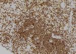 CDC25A Antibody in Immunohistochemistry (Paraffin) (IHC (P))