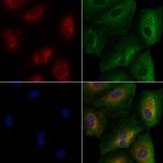 FAAH Antibody in Immunocytochemistry (ICC/IF)