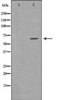 GGA2 Antibody in Western Blot (WB)