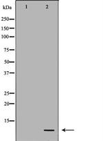 DEFB121 Antibody in Western Blot (WB)