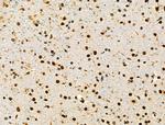 CD3d Antibody in Immunohistochemistry (Paraffin) (IHC (P))