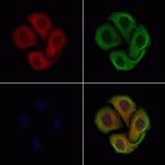 HFE Antibody in Immunocytochemistry (ICC/IF)