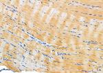 HFE Antibody in Immunohistochemistry (Paraffin) (IHC (P))