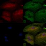 HLA-DR/DP Antibody in Immunocytochemistry (ICC/IF)