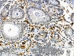 HLA-DR/DP Antibody in Immunohistochemistry (Paraffin) (IHC (P))