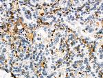 HLA-DR/DP Antibody in Immunohistochemistry (Paraffin) (IHC (P))