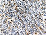 HLA-DR/DP Antibody in Immunohistochemistry (Paraffin) (IHC (P))