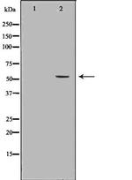 LIPC Antibody in Western Blot (WB)