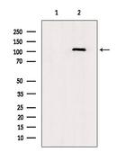 TLR8 Antibody in Western Blot (WB)