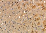 RENT1 Antibody in Immunohistochemistry (Paraffin) (IHC (P))