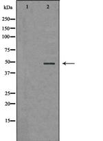 PSMC5 Antibody in Western Blot (WB)