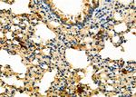 NAT1 Antibody in Immunohistochemistry (Paraffin) (IHC (P))