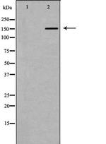 A2M Antibody in Western Blot (WB)