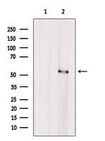 SERPINC1 Antibody in Western Blot (WB)