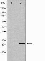 IFN beta Antibody in Western Blot (WB)