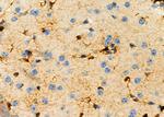 Factor IX Antibody in Immunohistochemistry (Paraffin) (IHC (P))