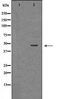 Renin Antibody in Western Blot (WB)