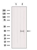 SULT1A1 Antibody in Western Blot (WB)