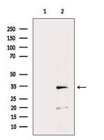 SULT1A1 Antibody in Western Blot (WB)