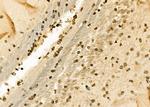 TAP2 Antibody in Immunohistochemistry (Paraffin) (IHC (P))