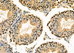 TAP2 Antibody in Immunohistochemistry (Paraffin) (IHC (P))