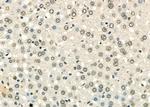 TAP2 Antibody in Immunohistochemistry (Paraffin) (IHC (P))