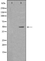 KIR3DL1 Antibody in Western Blot (WB)