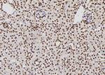 XPA Antibody in Immunohistochemistry (Paraffin) (IHC (P))