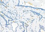 CD162 Antibody in Immunohistochemistry (Paraffin) (IHC (P))