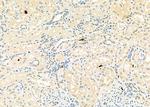 CD162 Antibody in Immunohistochemistry (Paraffin) (IHC (P))