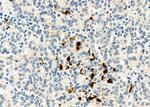 CD162 Antibody in Immunohistochemistry (Paraffin) (IHC (P))