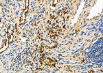 CD162 Antibody in Immunohistochemistry (Paraffin) (IHC (P))