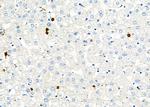 CD162 Antibody in Immunohistochemistry (Paraffin) (IHC (P))