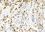 CD162 Antibody in Immunohistochemistry (Paraffin) (IHC (P))