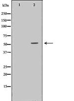 C1 inhibitor Antibody in Western Blot (WB)