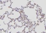 POLR2E Antibody in Immunohistochemistry (Paraffin) (IHC (P))