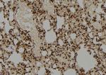 CSN5 Antibody in Immunohistochemistry (Paraffin) (IHC (P))