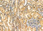 CSN5 Antibody in Immunohistochemistry (Paraffin) (IHC (P))