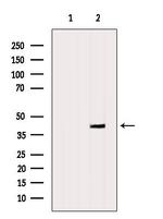 HMBS Antibody in Western Blot (WB)