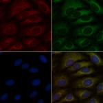 SLC22A6 Antibody in Immunocytochemistry (ICC/IF)