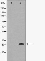 SFTPC Antibody in Western Blot (WB)