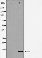 POLR2J Antibody in Western Blot (WB)