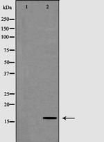 POLR2D Antibody in Western Blot (WB)