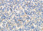 IL24 Antibody in Immunohistochemistry (Paraffin) (IHC (P))