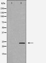 IL24 Antibody in Western Blot (WB)