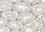 CADM1 Antibody in Immunohistochemistry (Paraffin) (IHC (P))