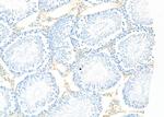 CADM1 Antibody in Immunohistochemistry (Paraffin) (IHC (P))